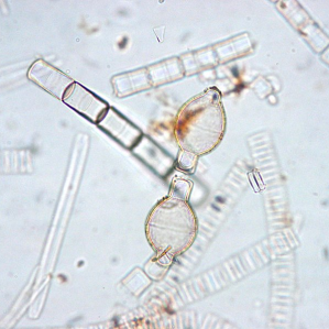 Diatoms